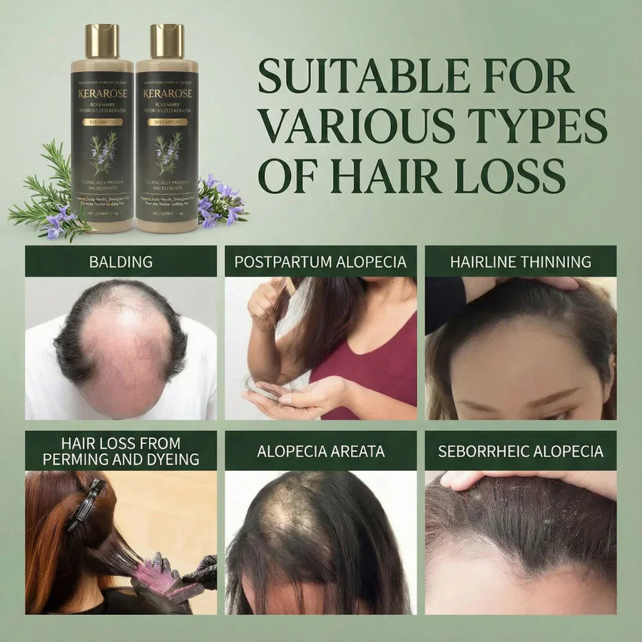 Gentle, even on sensitive scalps