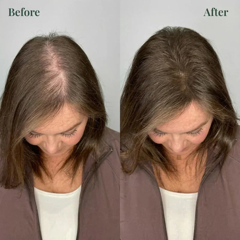 Kerarose Rosemary Shampoo For Hair Growth